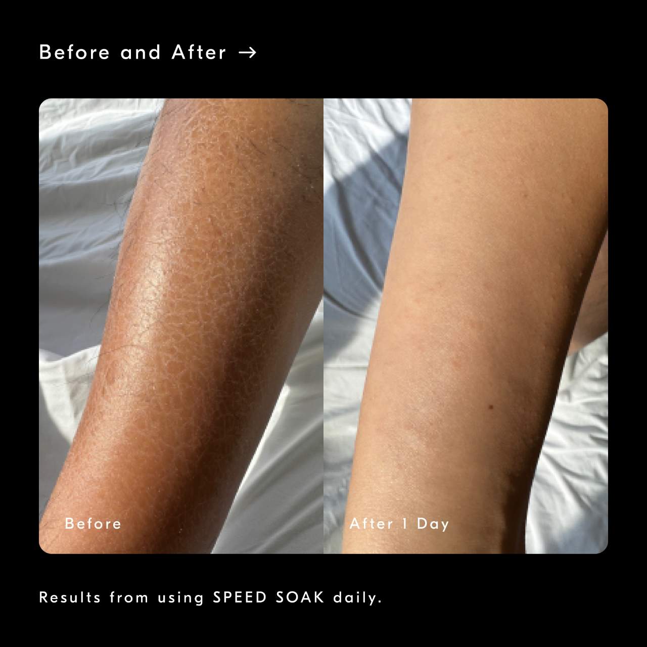 Speed Soak Fast-absorbing + Hydrating Body Gel Moisturizer | SHOP BAZAAR